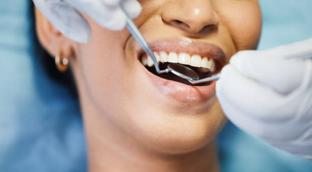 Best Walk-In Emergency Dentist in La Villa, TX